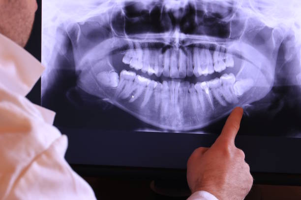 Best Walk-In Emergency Dental Services in East Lake Orient Park, FL